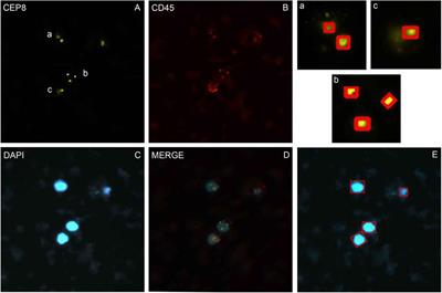 A New Method for CTC Images Recognition Based on Machine Learning